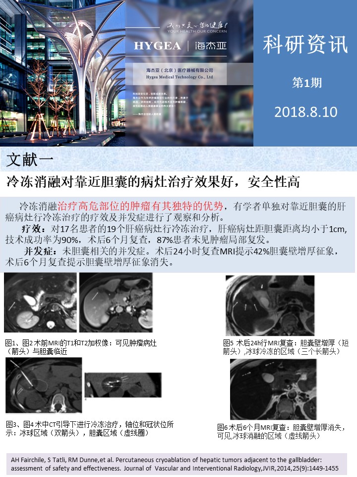 【海杰亞科研資訊】第1期——肝、肺癌消融